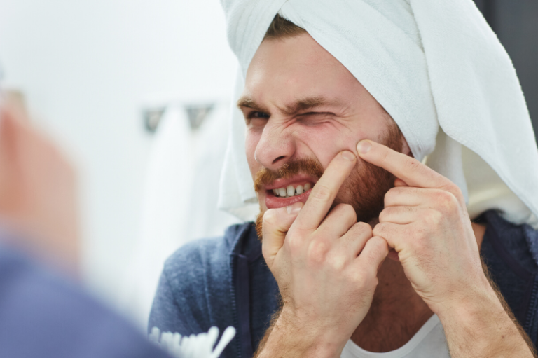 Best Beard Oil For Acne Prone Skin Best Grooming Tips 2021