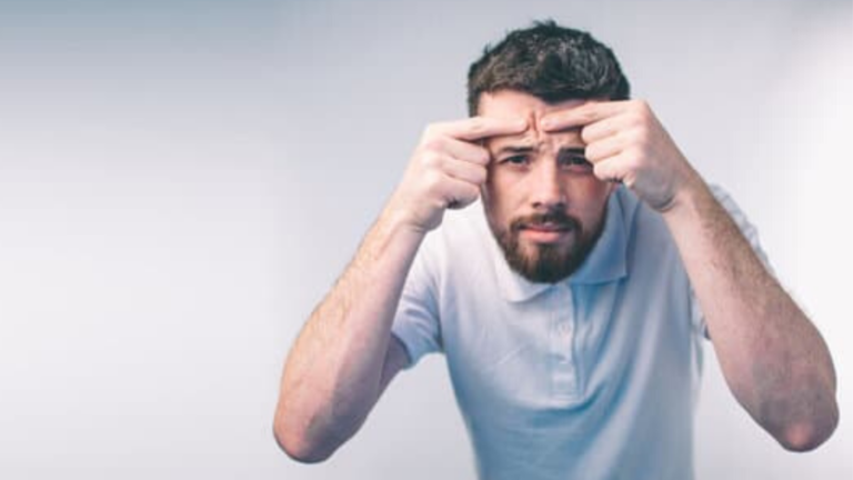 Does Acne Affect Beard Growth It Doesn t Then 