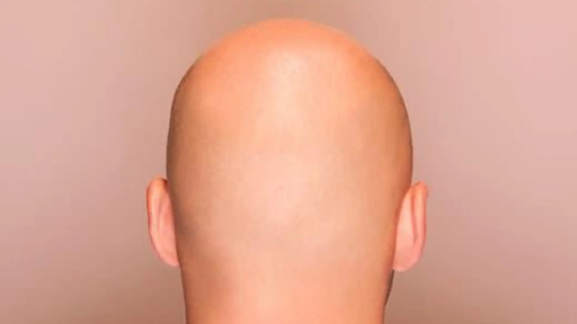 do bald men shines their head